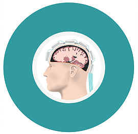 TBD Labs - Electrical Impedance Imaging